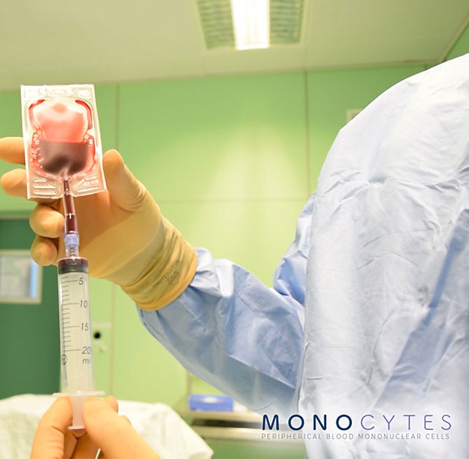 Monocytes-Orto-TissYou-Biological-Company